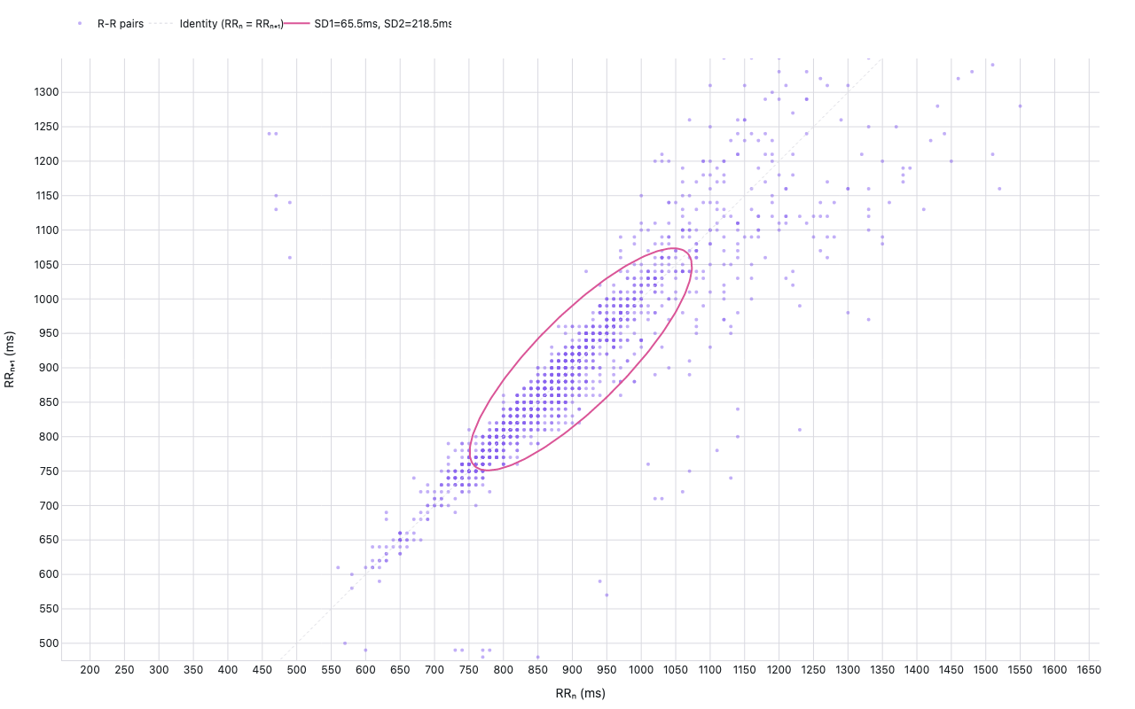 Poincaré plot of successive R-R intervals with SD1/SD2 ellipse